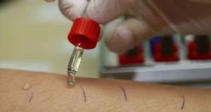 Son 10 yılın alerji salgını!