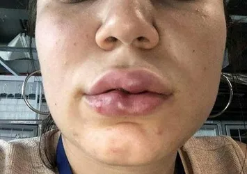 Doktordan pes dedirten savunma! Genç kadın bu hale gelmişti...
