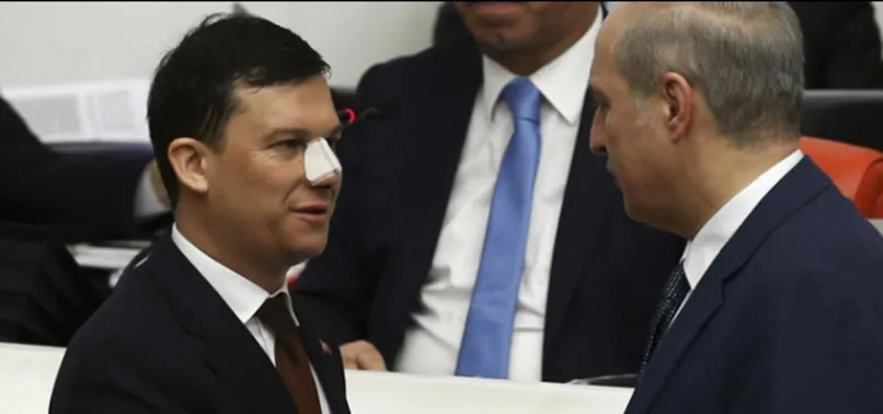 AK Partili vekil burnunu kimin kırdığını açıkladı