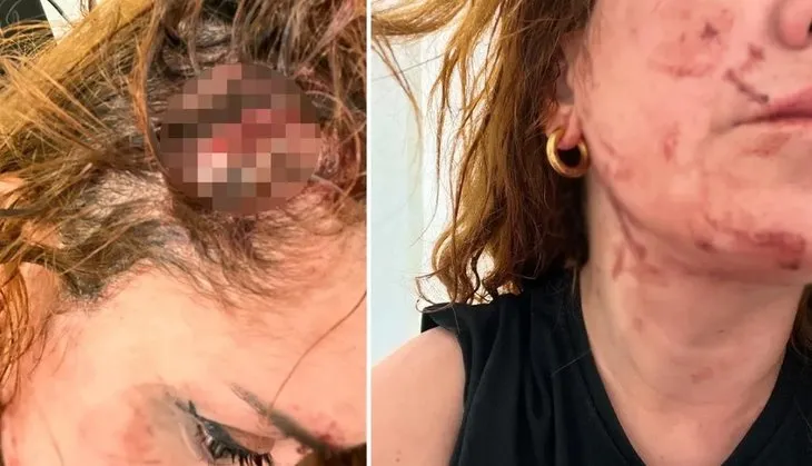 İstanbul’da çivili sopa dehşeti! Dövme sanatçısı ve sevgilisi kabusu yaşadı | İfadeleri ortaya çıktı