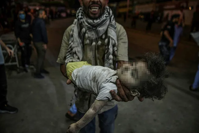 Katil İsrail’in çocuk katliamı | A Haber çatışma bölgesinde! Canlı yayında bombardıman