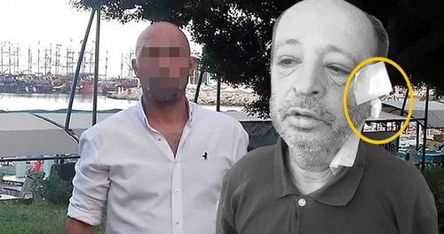 Arkadaşının kulağını maket bıçağıyla kesti! Sebebi ise tüyler ürpertti... - 3