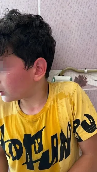 Bu nasıl öğretmen! Öğrencisini kaynar suyla yaktı - 4