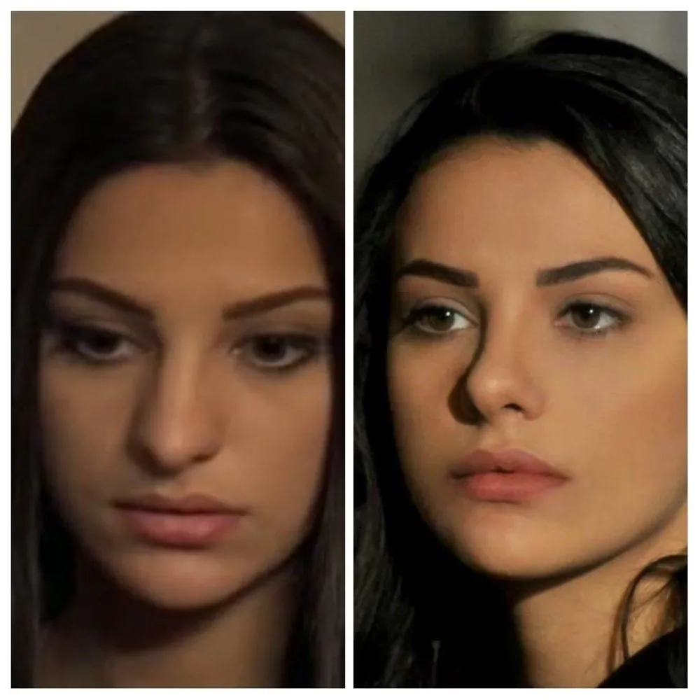 ada masali nin haziran i ayca aysin turan estetik harikasi cikti degisimi pes dedirtti