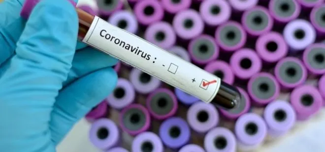İTÜ koronavirüs tanısını 90 dakikada koyabilen cihaz geliştirdi