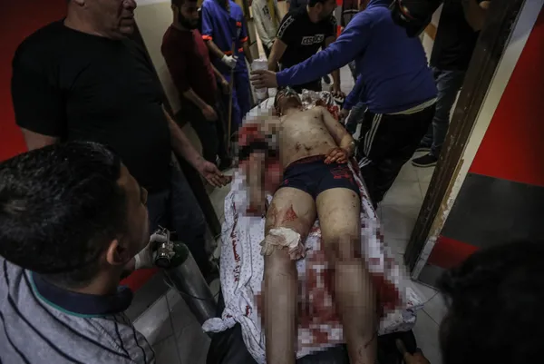 İsrail’in kullandığı gizli silahı ifşa oldu! BBC muhabiri Gazze’deki vahşeti anlattı