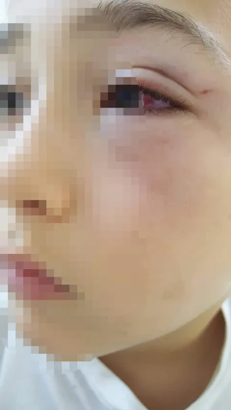Oğluyla tartışan 9 yaşındaki çocuğu darp etti - 3