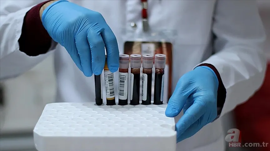 Kan grubuna göre nasıl beslenilmeli? O yeşilliklere dikkat 1