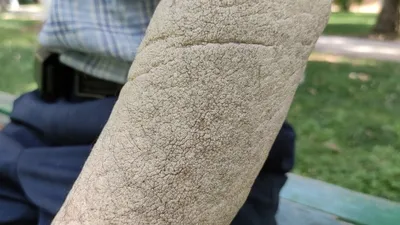 Tüm vücudunu sardı