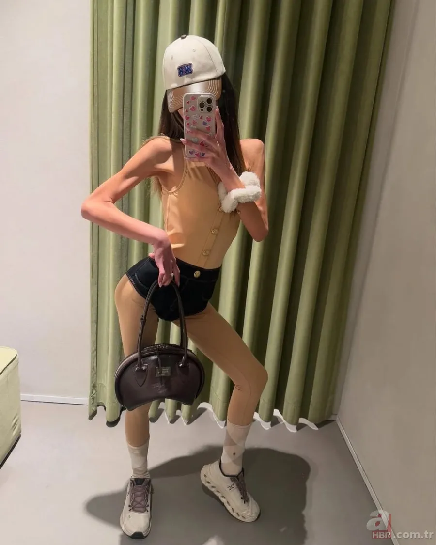 Nihal Candan'ın son hali şoke etti! Annesi gözyaşlarıyla anlattı! "Sadece iki şey tüketiyor" 3