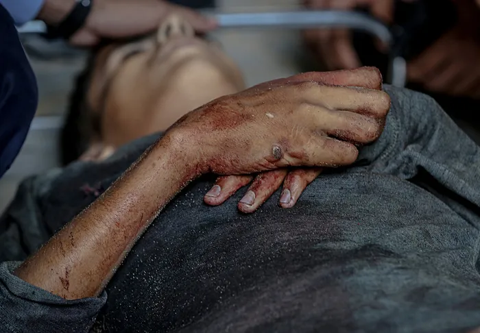 gazzeye-topyekun-olum-fermani-katliam-icin-60-bin-asker-goreve-cagrildi-israil-savunma-bakani-katz-onayladi-1755673198681.jpg Gazze Şeridi, AFP