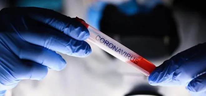 Bilim Kurulu Üyesi Kayıpmaz: Koronavirüs tedavisinde hekime başvurmadan aspirin kullanmayın
