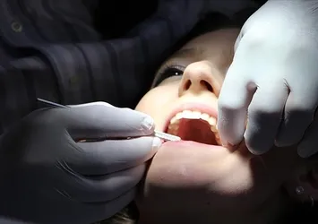 Uzmanından kritik uyarı: Diş eti problemleri sessiz ilerliyor