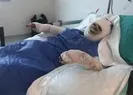 Kayınvalidesini yakıp izledi