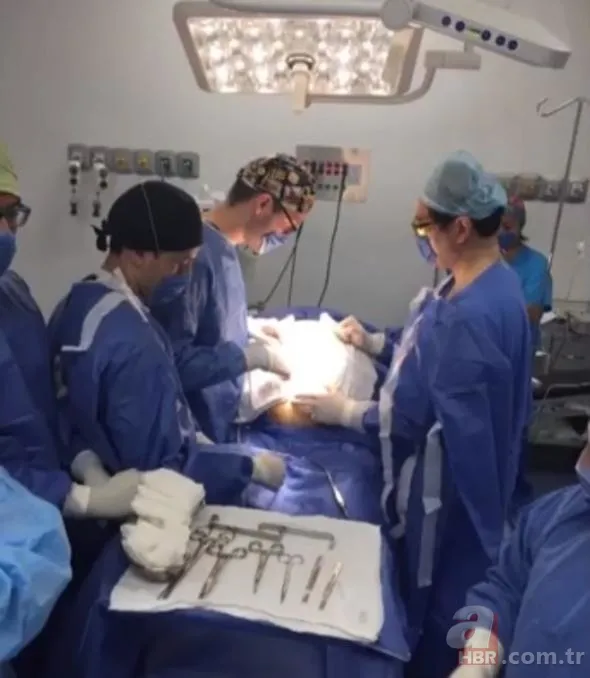 Doktorlar bile hamile sandı! Çıkanlara kimse inanamadı... 8