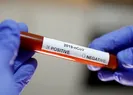 Sinopta 3 köyde karantina başlatıldı