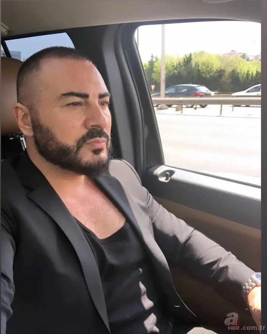 Rober Hatemo'nun son görüntüsü olay oldu! Yüzüne bakın ne yaptırmış! 'Yenilendim' 4