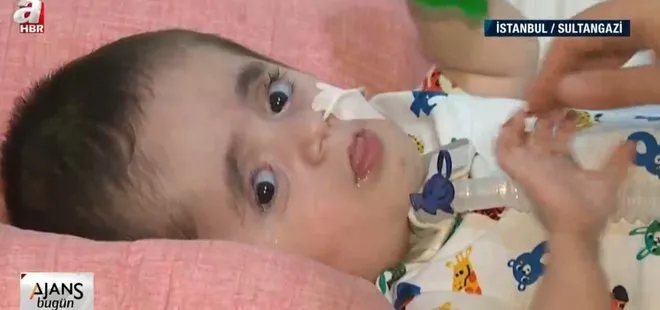 Anne karnında ’cam kemik’ hastalığına yakalanan Ömer Ali’nin yaşam mücadelesi