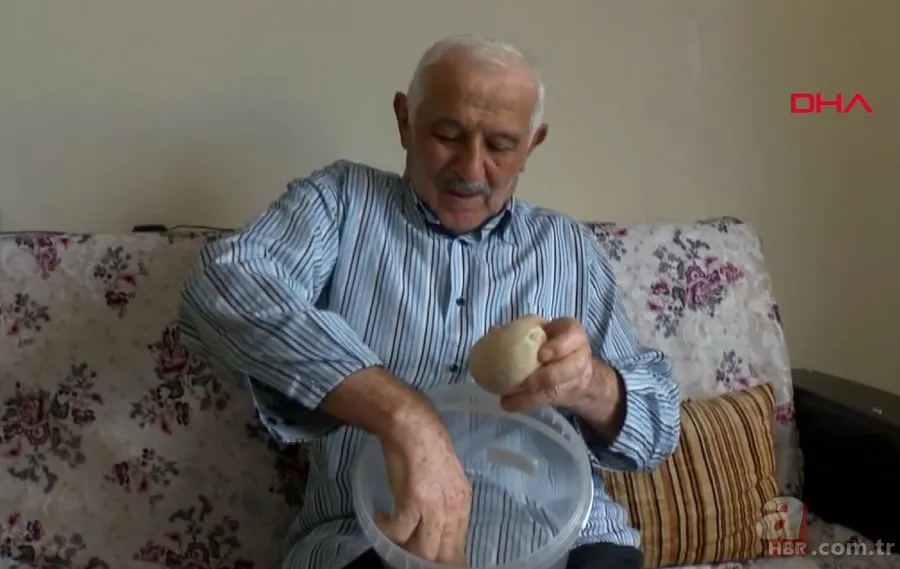 Karın bölgesinde şişlik ve halsizlik şikayetiyle doktora gitti! Karnından çıkanlar şoke etti 19