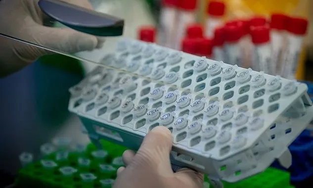 DSÖ üst düzey danışmanı Dr. Bruce Aylward: Test yaparak salgının sonunu getirebiliriz - 2