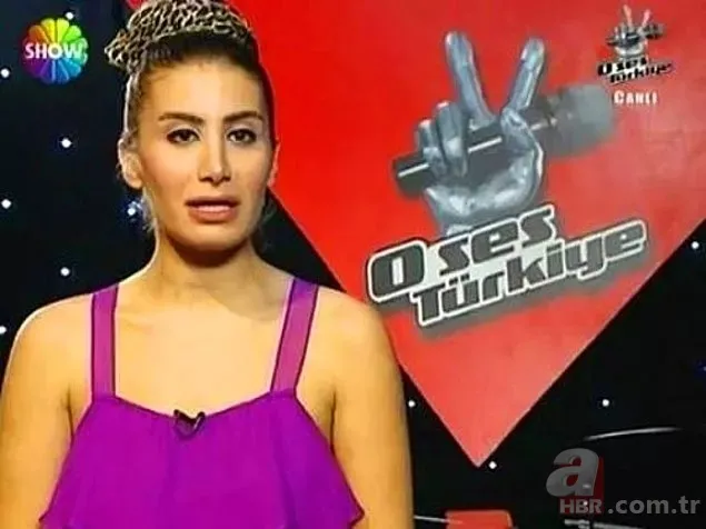 Fotoğrafı şaşkına çevirmişti! Demet Özdemir iddiaları ti’ye aldı! “Bugün estetiği fazla kaçırdım” 9