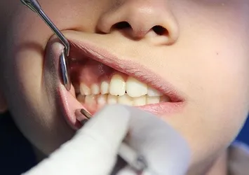 Uzmanı uyardı! Şekerden sonra tüketince çürümeyi önlüyor...