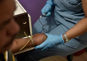 Zika virüsüne karşı aşı deneyi