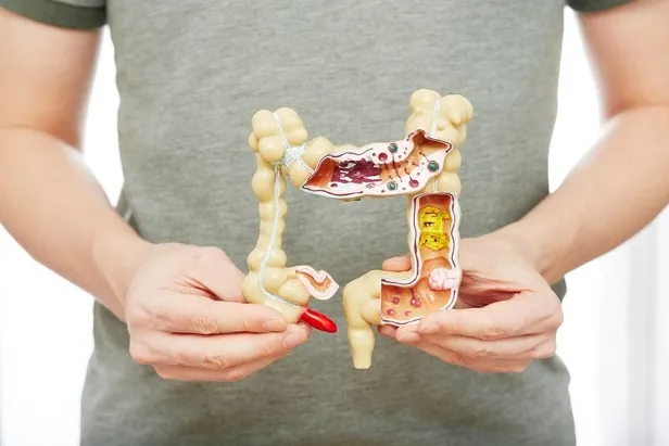 Kabızlık sorununu kökünden çözen doğal karışım: Yoğurdun içine bir kaşık ekleyin!