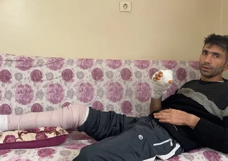 3 günde 3 farklı şehirde 3 olay! Komşusunun köpeği elini parçaladı ölümden döndü