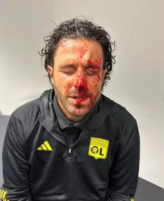 Fransa Birinci Futbol Ligi’nde kanlı gece: Teknik adama korkutan saldırı! Maç ertelendi