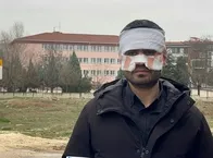 Lisede dehşet anları! Öğretmenin yüzüne kaynar çay fırlattı