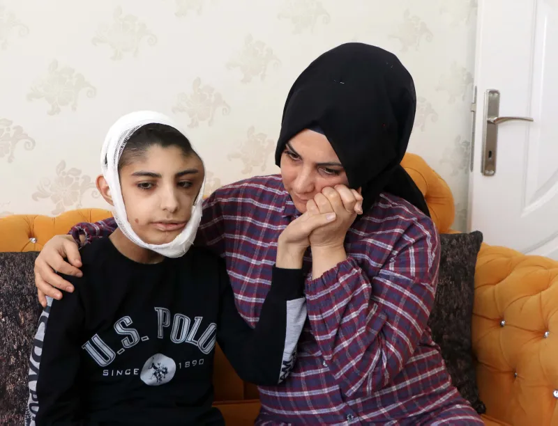Çenesinin altına kadar indi! Yüzündeki yara her geçen gün büyüyor