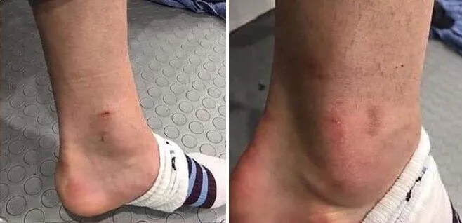 Spor hukukçusu Köse: Sörloth'un cezası iner - 1