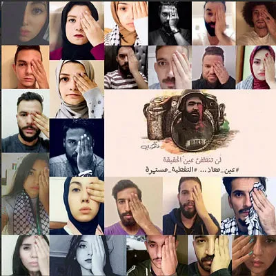 İşgalci İsrail askerinin ateşi sonrası gözünü kaybetmişti: Sahalara geri dönüp çektiğim acıları ve işgalciyi yeneceğim