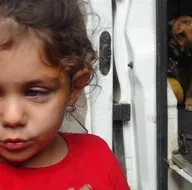 Köpek severken dehşeti yaşadı