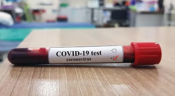 mutasyonlu-virusun-ilk-goruldugu-illerden-balikesirde-valilikten-vatandaslara-flas-uyari-1615219716048.jpg Mutasyonlu virüsün ilk görüldüğü illerden Balıkesir'de valilikten vatandaşlara flaş uyarı! - 3