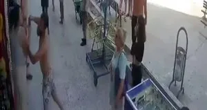 Sevgili dehşeti! Darp edildi: Dişleri kırıldı