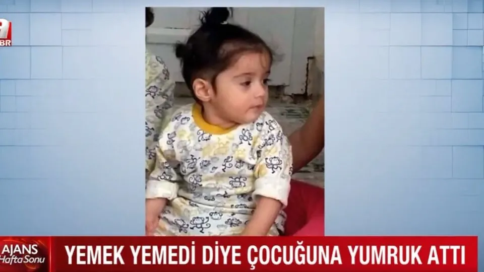 Yemek Yemedi Diye Cocuguna Yumruk Atti 1 5 Yasindaki Elif I Baba Yumrugu Oldurdu Ahaber Video Izle