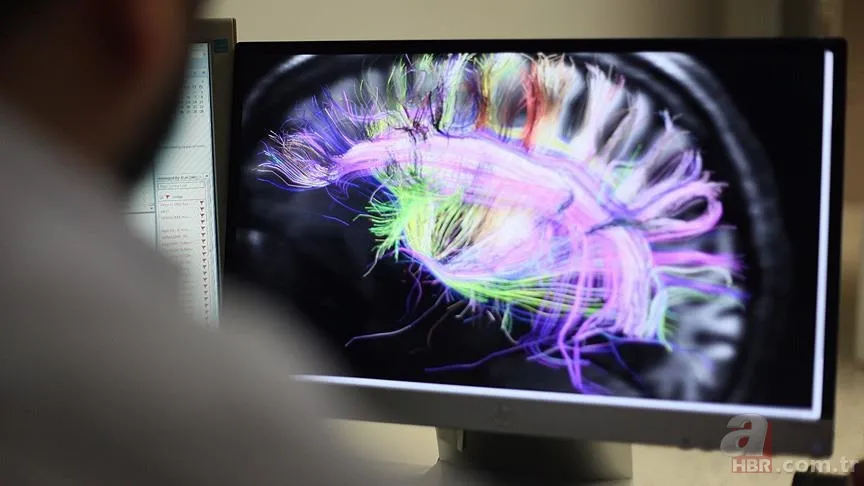 O çikolatadan bir ısırık alın! Zekayı ve hafızayı çalıştıran araştırma ortaya çıktı 3