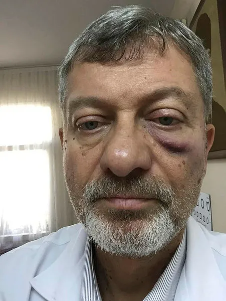 Rapor alamayan hasta, doktora kafa attı - 1