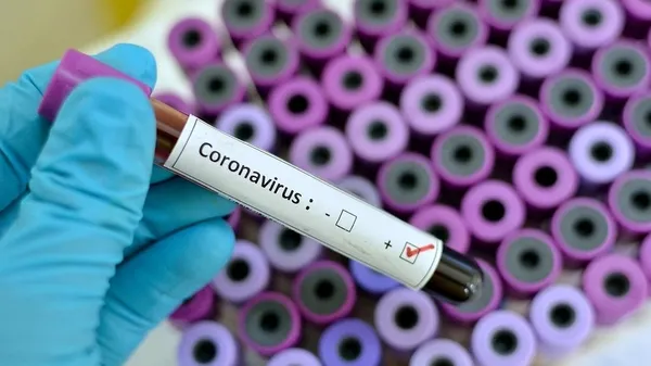 soke-eden-iddia-koronavirus-isinlanmayla-mi-yayildi-dikkat-ceken-ornek-1608100962252.jpg Şoke eden iddia: Koronavirüs ışınlanmayla mı yayıldı? Dikkat çeken örnek... - 2