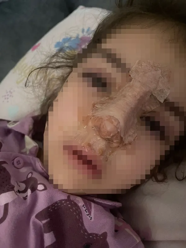 kreste-psikolojik-siddet-iddiasi-4-yasindaki-kizin-burnu-kirildi-1701672605874.jpg Kreşte psikolojik şiddet iddiası! 4 yaşındaki kızın burnu kırıldı - 1