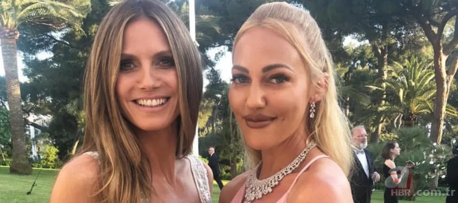 Estetiği fazla kaçıran Meryem Uzerli tanınmaz hale geldi! Ne yaptın kendine? 10