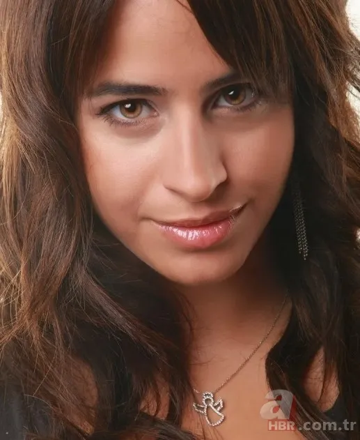 Büşra Pekin’de estetikle yeni birine dönüşenler kervanında! 1 estetiğim var deyince ti’ye alınmıştı… 4 bantla o hale gelmiş! 3