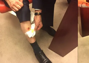 AK Partili Balta ısırıldığını raporla kanıtladı