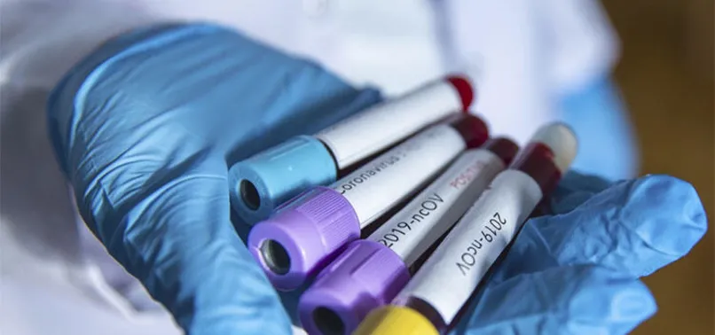 Dünyayı sarsan koronavirüse Türk profesör umut oldu! Sağlık Bakanı Ankara'ya davet etti