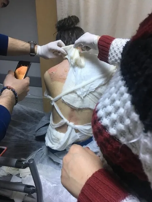 Kızının üstüne kaynar su döken üvey anne 4.5 yıl hapis istemi! Öz anne isyan etti! - 2