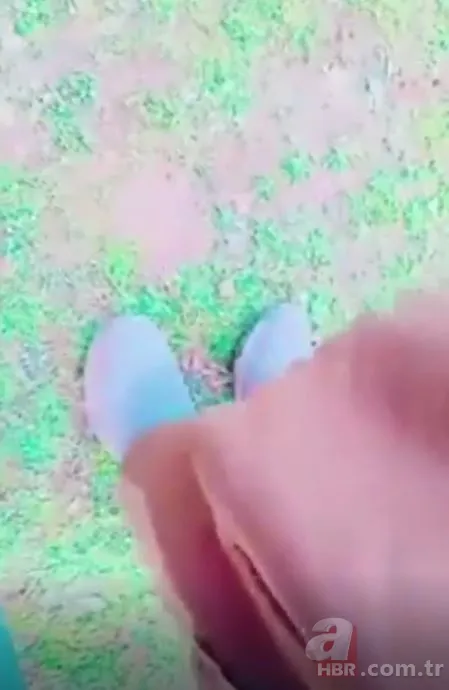 TikTok'taki meydan okuma hastanede bitti! Kendisini yaktı 20