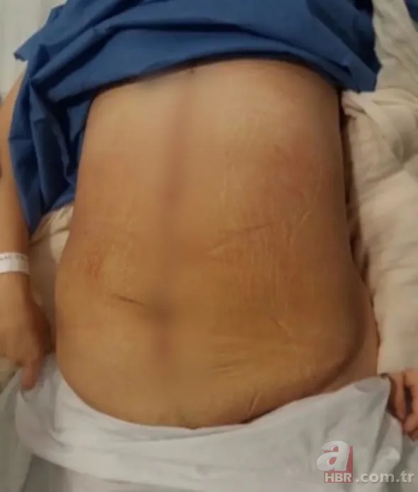 Doktorlar bile hamile sandı! Çıkanlara kimse inanamadı... 13