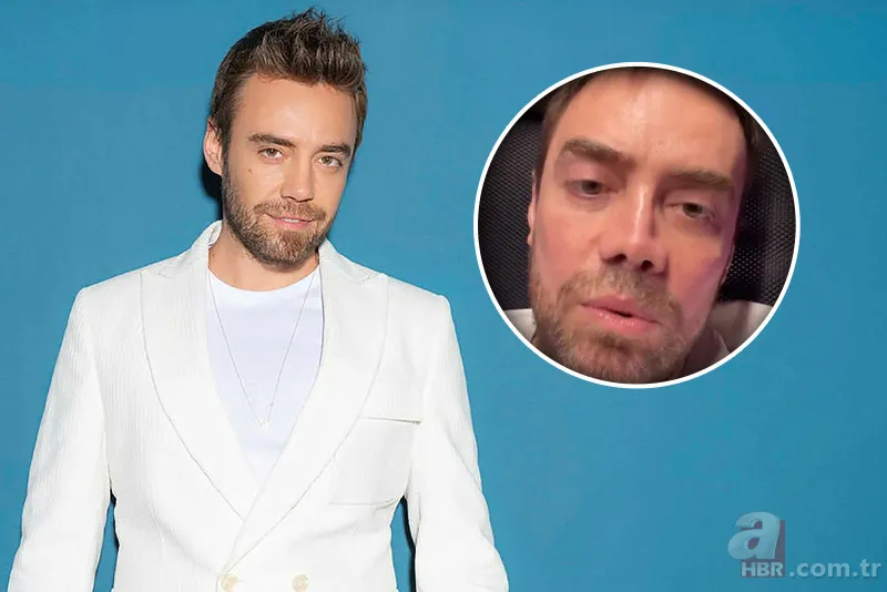 13. kez ameliyat olan Murat Dalkılıç: "2 sene sonra burnum oldu" 1